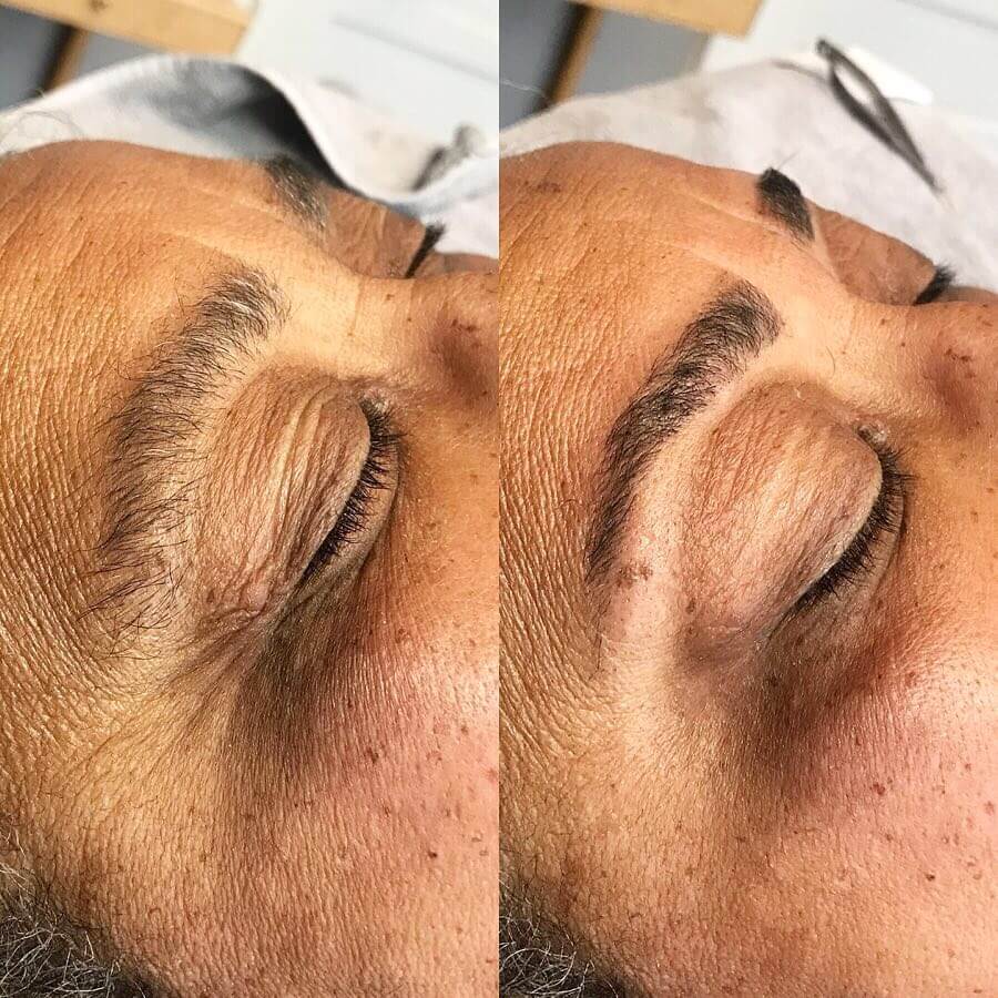 Close-up side-by-side comparison showing a person's eyebrow area before and after cosmetic enhancement. The left image shows sparse and uneven eyebrows, while the right image displays fuller, well-defined eyebrows.
